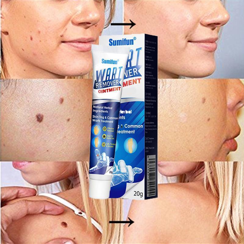 Instant Blemish Removal Gel (Limited time discount 🔥 last day)