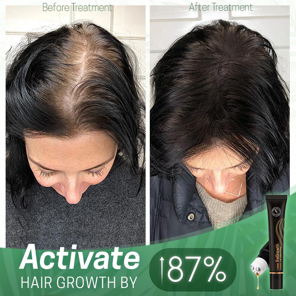 10X-Regro Organic Hair Serum Roller