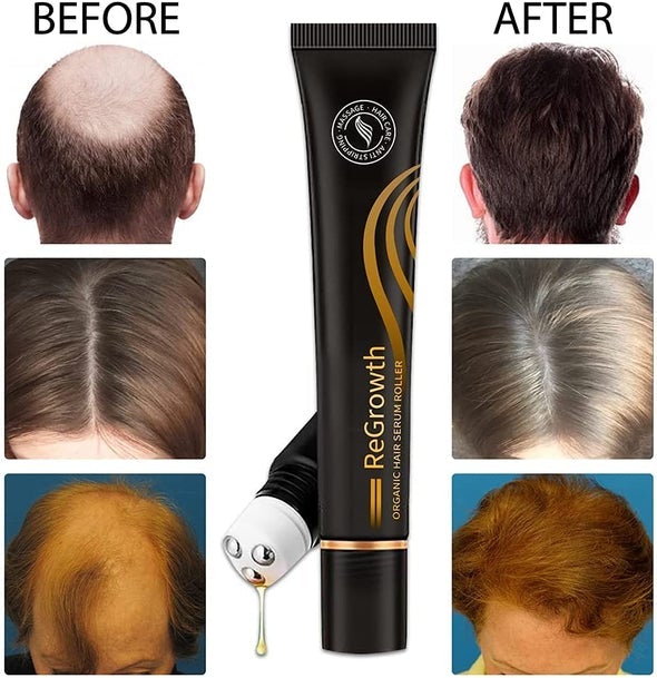 10X-Regro Organic Hair Serum Roller