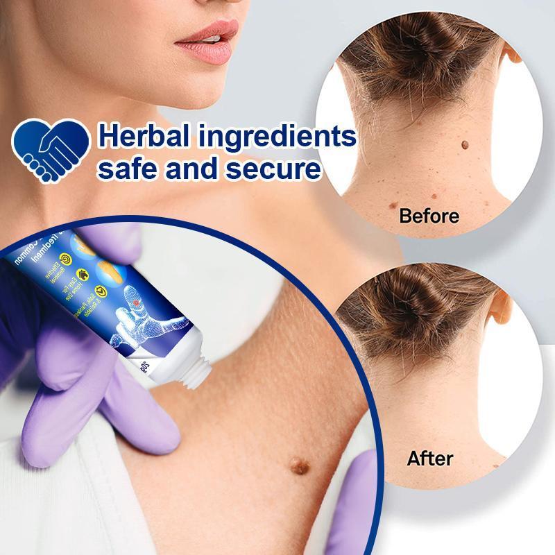 Instant Blemish Removal Gel (Limited time discount 🔥 last day)