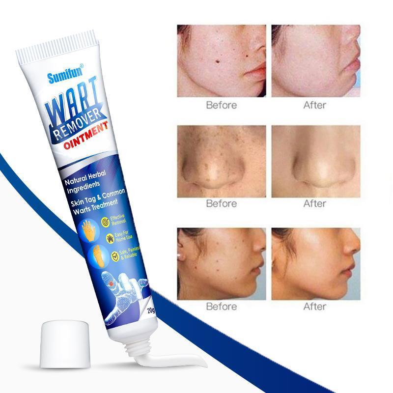 Instant Blemish Removal Gel (Limited time discount 🔥 last day)