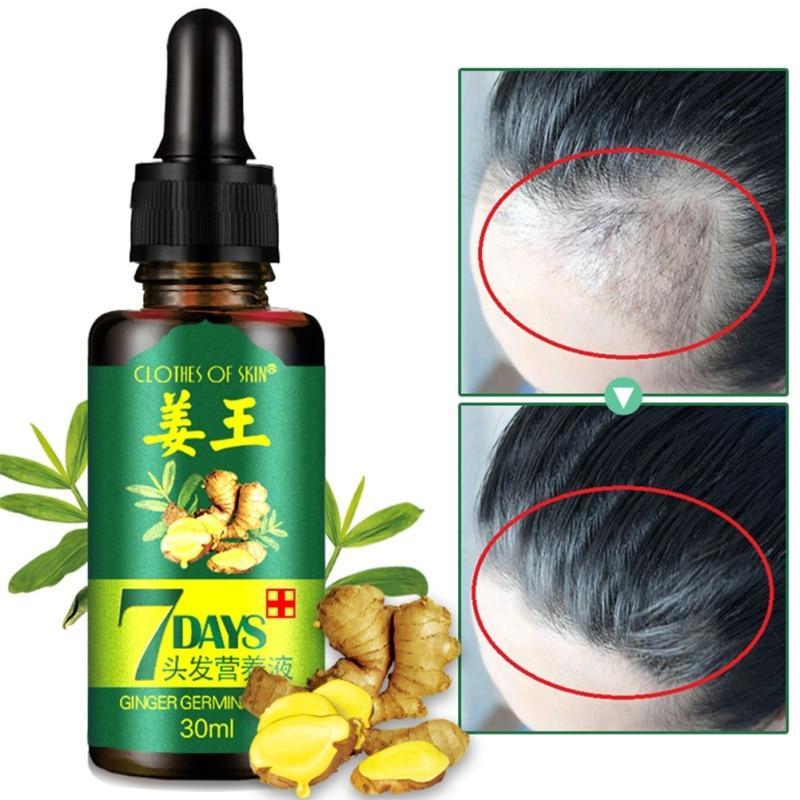 7 DAY HAIR GROWTH SERUM