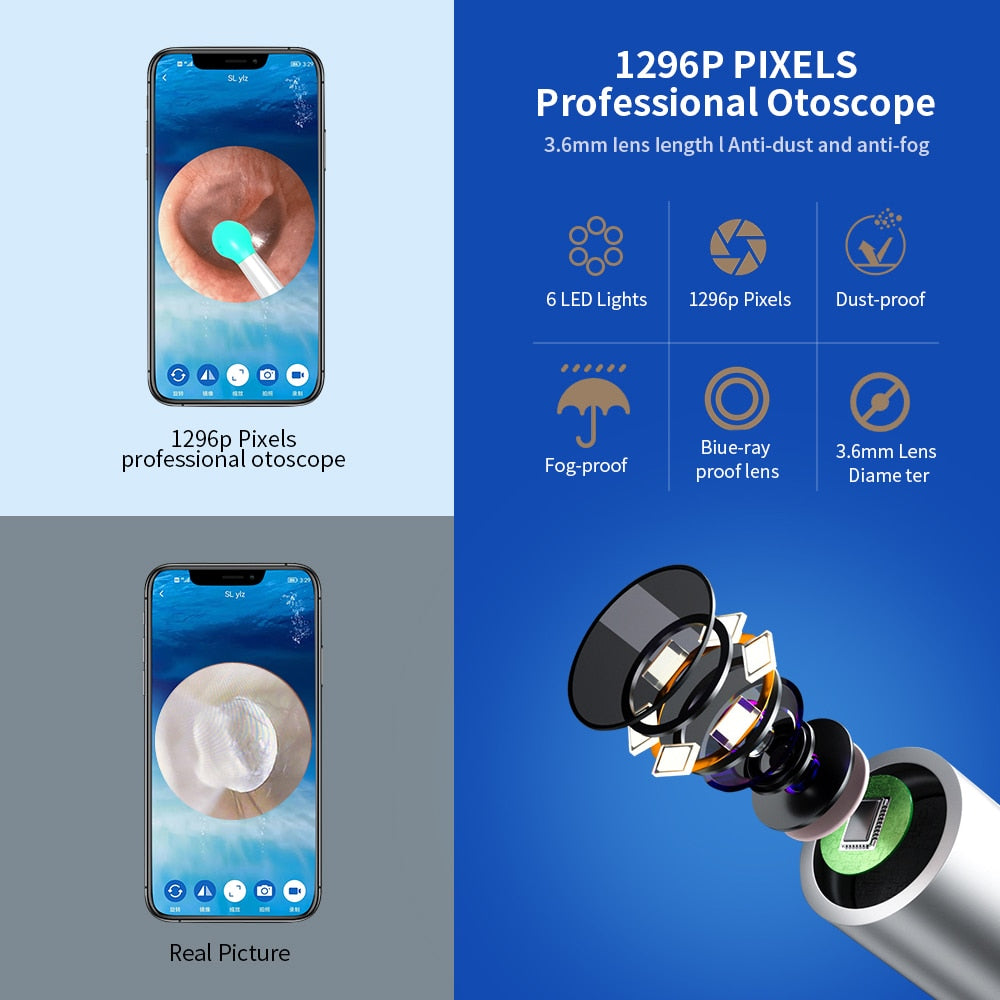 At-Home Wi-Fi OtoScope Ear Wax Remover