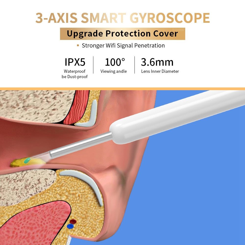 At-Home Wi-Fi OtoScope Ear Wax Remover