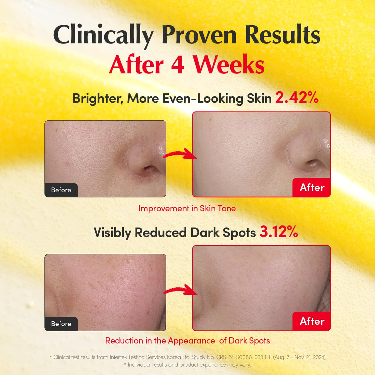 Vitamin Illuminating Serum for Dark Spots & Brightening