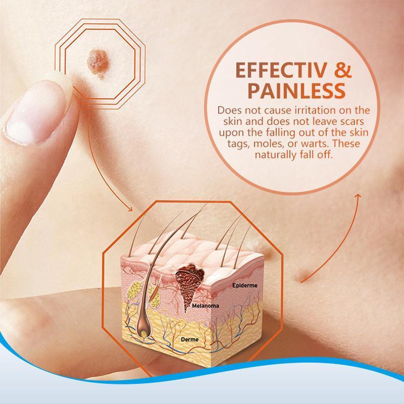 Instant Blemish Removal Gel (Limited time discount 🔥 last day)