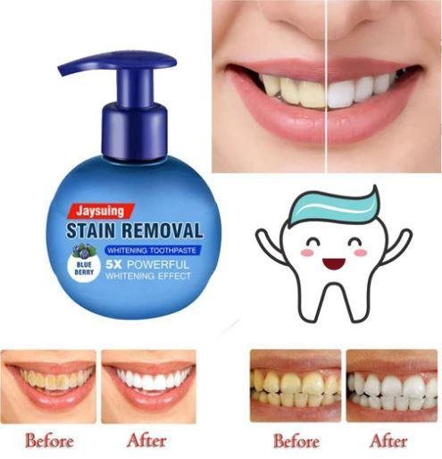 Intensive Stain Removal Whitening Toothpaste