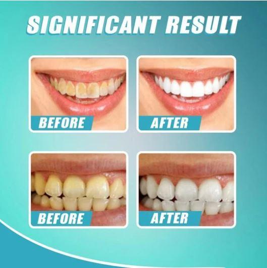 Intensive Stain Removal Whitening Toothpaste