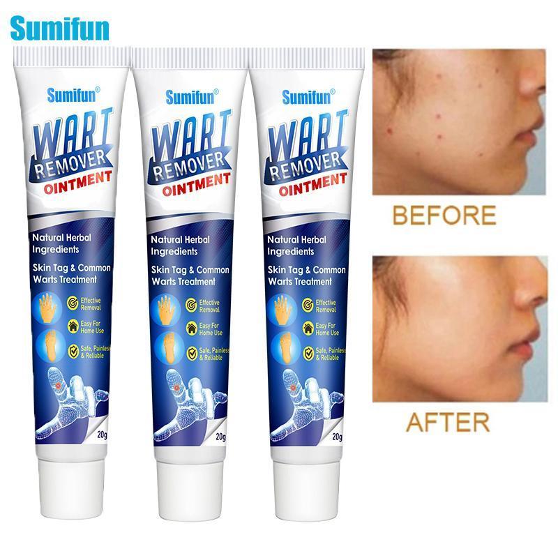 Instant Blemish Removal Gel (Limited time discount 🔥 last day)