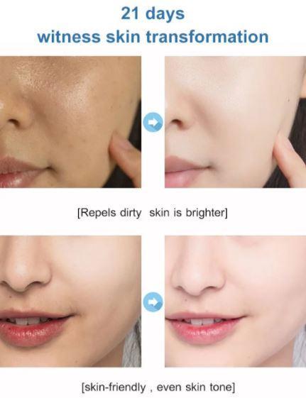 SALICYLIC ACID ICE CREAM MASK